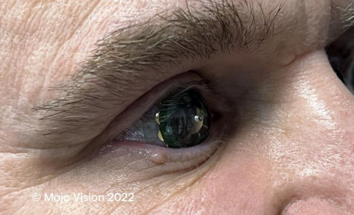 Mojo Vision sötét látás kontaktlencse