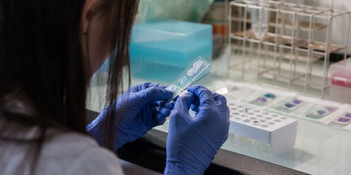 DNS-tesz élettárs testvér